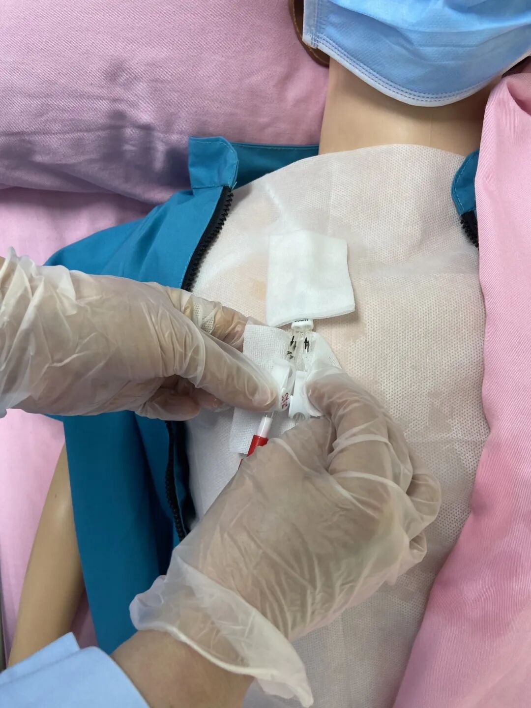 无菌纱块怎么使用一文让你学会透析导管自我换药_https://www.jmylbn.com_新闻资讯_第51张