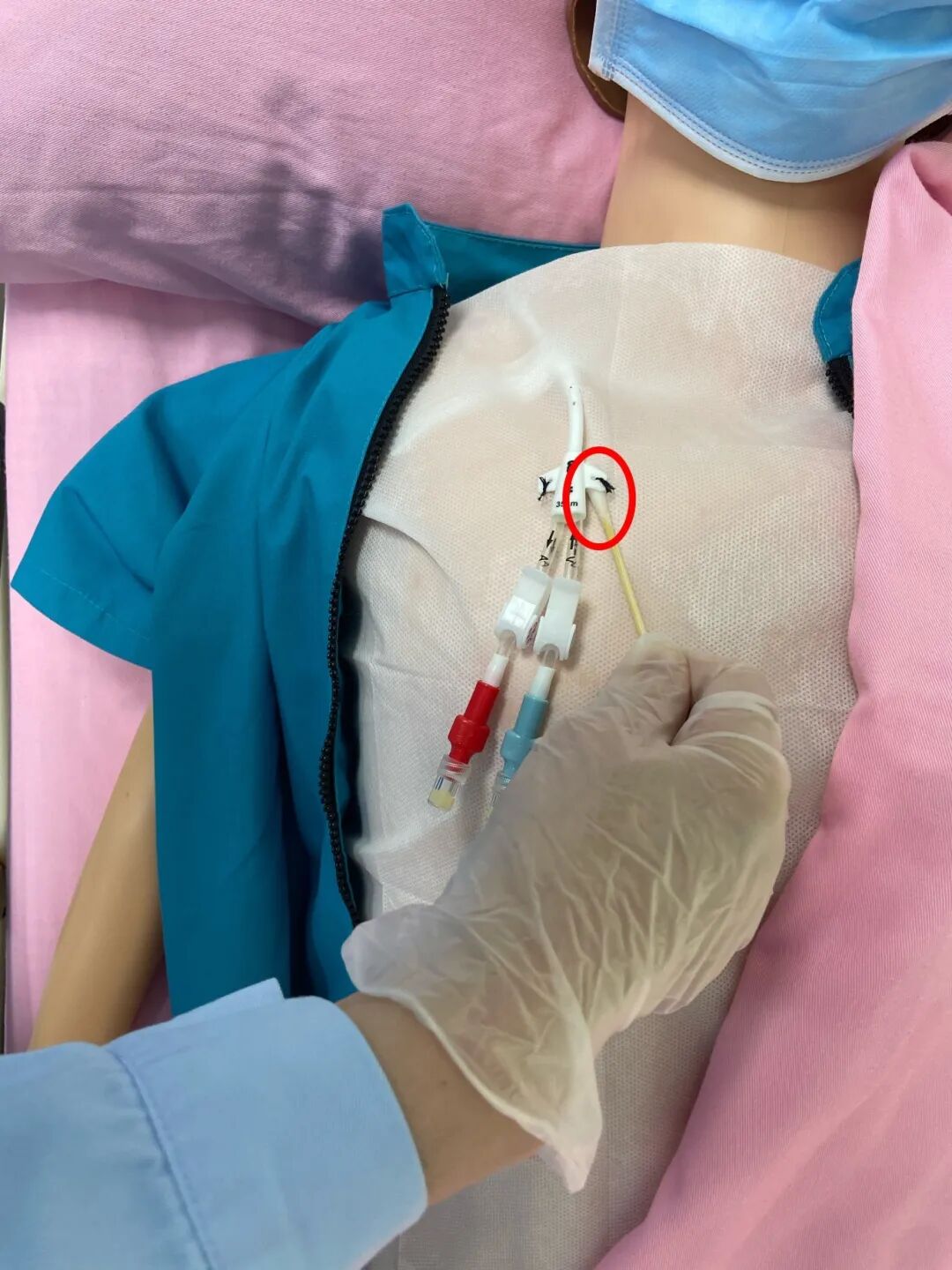 无菌纱块怎么使用一文让你学会透析导管自我换药_https://www.jmylbn.com_新闻资讯_第79张