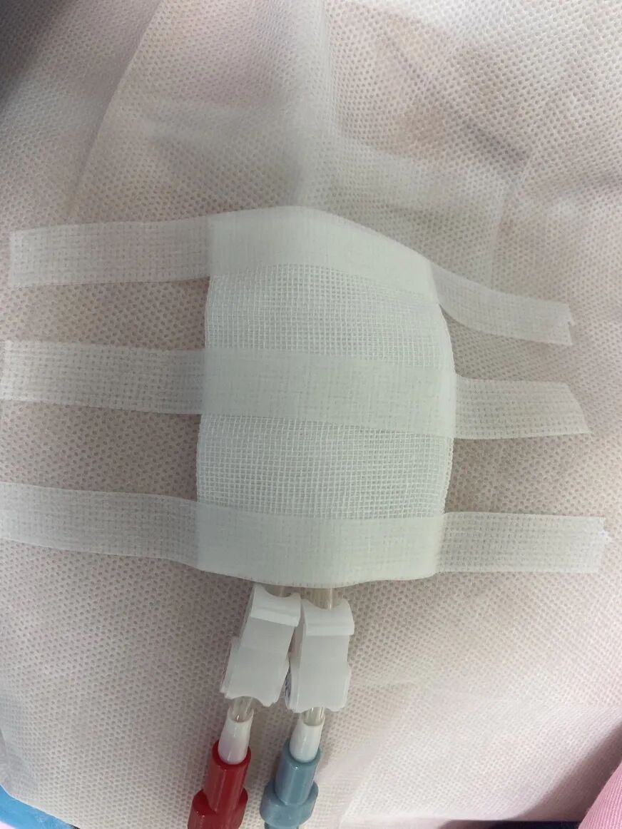 无菌纱块怎么使用一文让你学会透析导管自我换药_https://www.jmylbn.com_新闻资讯_第95张