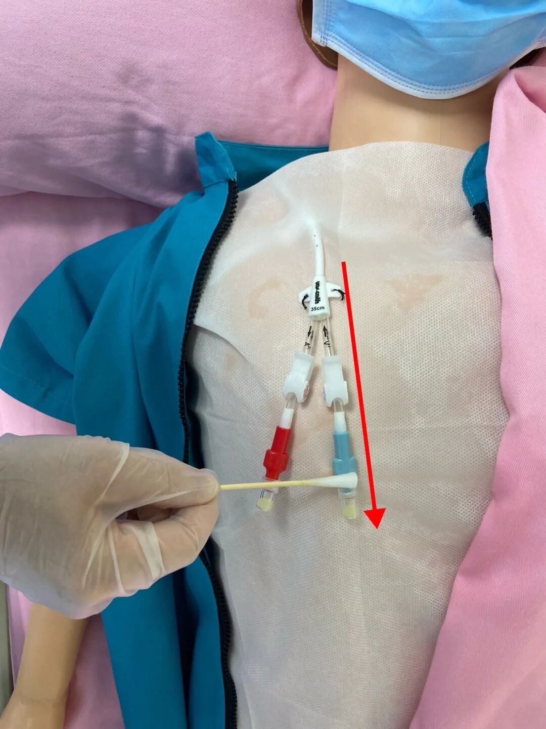 无菌纱块怎么使用一文让你学会透析导管自我换药_https://www.jmylbn.com_新闻资讯_第73张