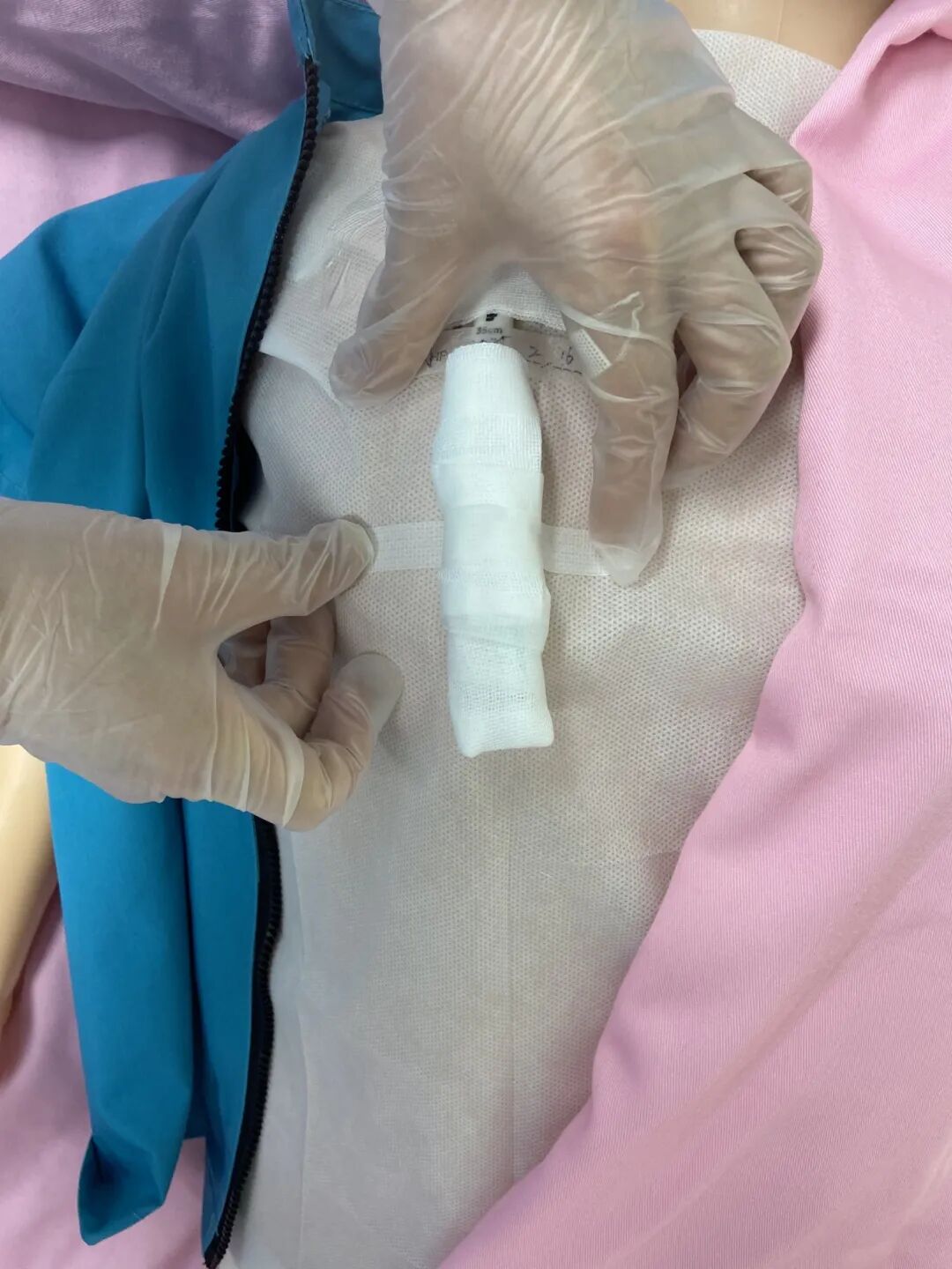 无菌纱块怎么使用一文让你学会透析导管自我换药_https://www.jmylbn.com_新闻资讯_第106张