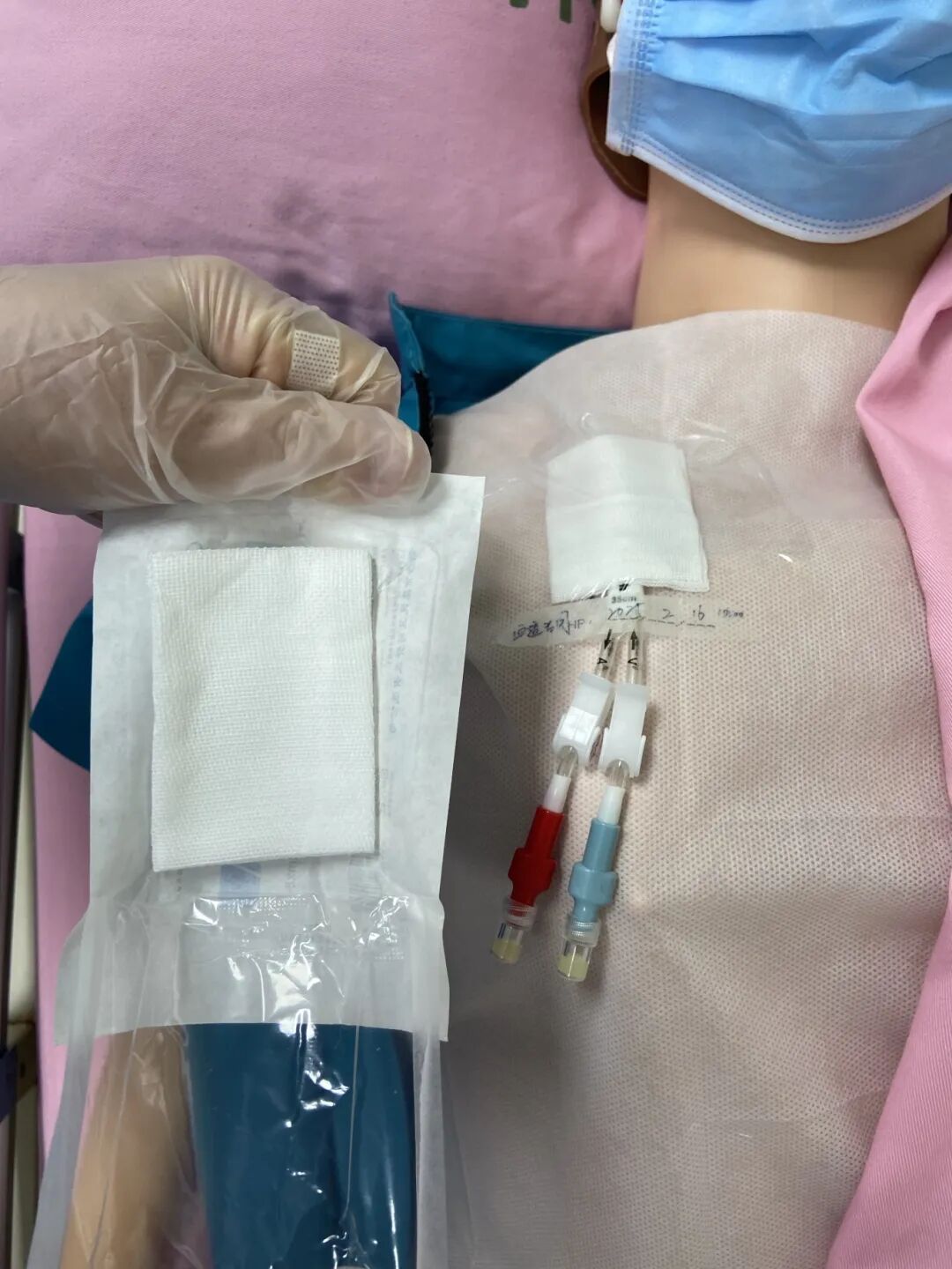 无菌纱块怎么使用一文让你学会透析导管自我换药_https://www.jmylbn.com_新闻资讯_第97张