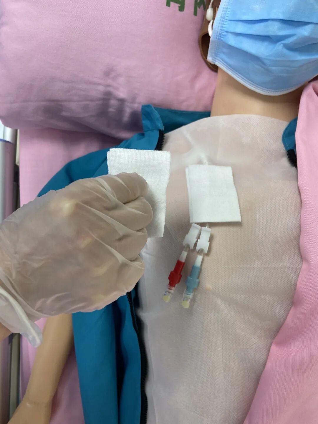 无菌纱块怎么使用一文让你学会透析导管自我换药_https://www.jmylbn.com_新闻资讯_第86张