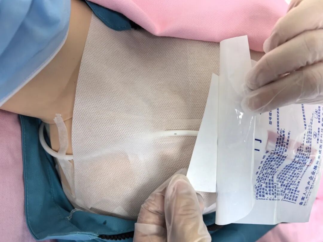 无菌纱块怎么使用一文让你学会透析导管自我换药_https://www.jmylbn.com_新闻资讯_第126张