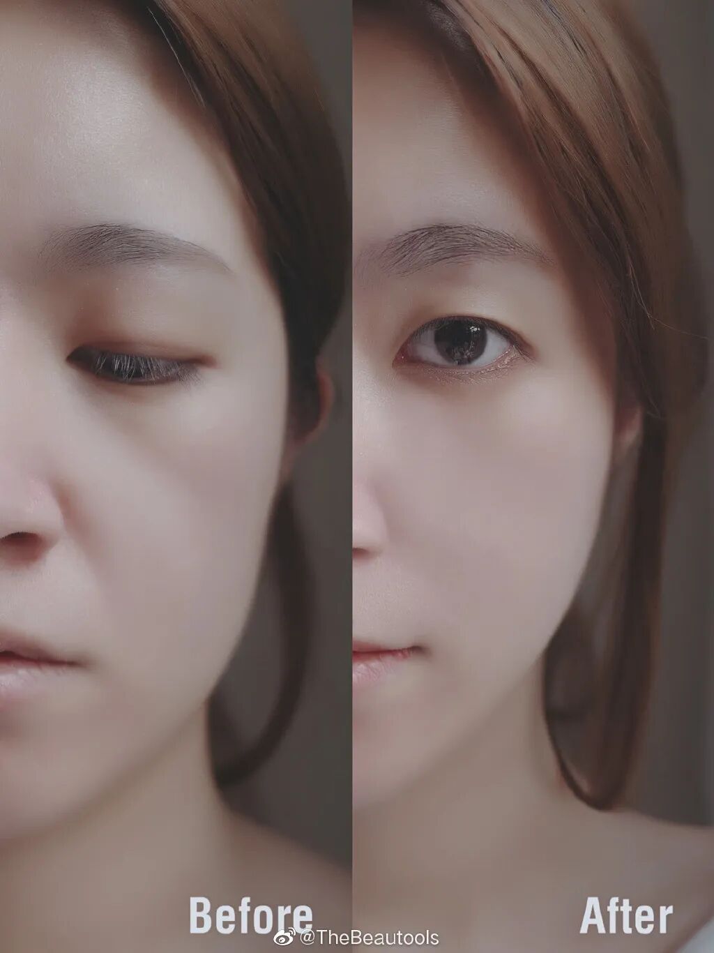 3分钟做一次v脸 线雕 拍照不用开瘦脸了 良仓 微信公众号文章阅读 Wemp