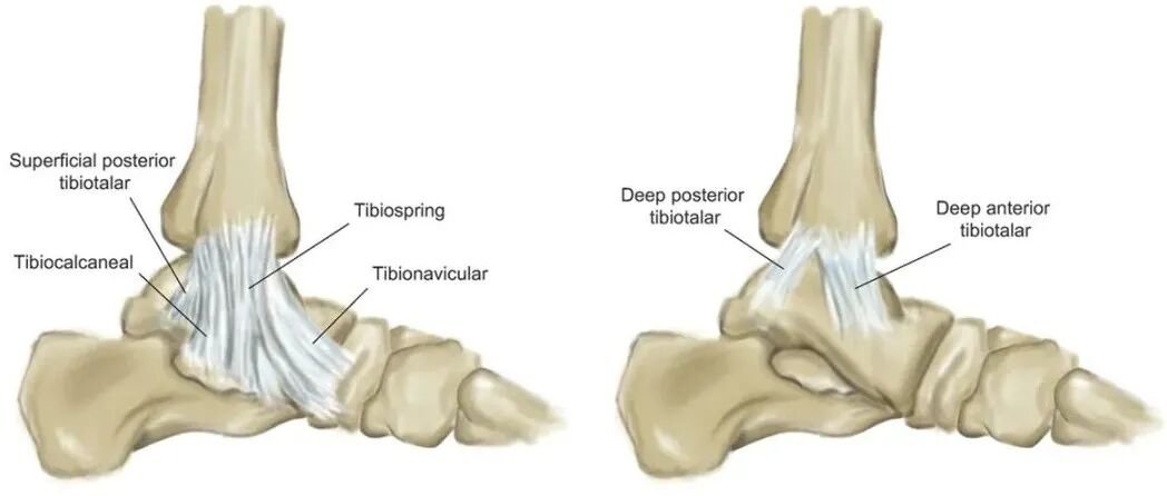 三角韧带损伤：何时修复以及如何修复？