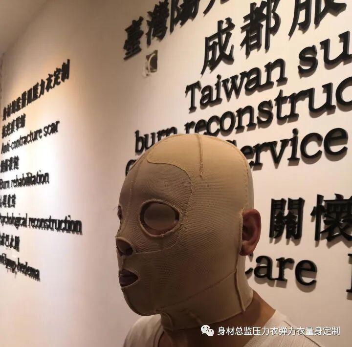 医用夹板怎么软化烧伤患者避免走弯路必读！！！烧伤康复指南--物理治疗、职业治疗、烧伤疤痕挛缩、烧伤压力衣弹力衣定制_https://www.jmylbn.com_新闻资讯_第32张