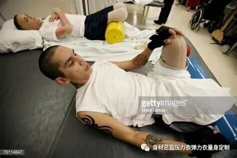 医用夹板怎么软化烧伤患者避免走弯路必读！！！烧伤康复指南--物理治疗、职业治疗、烧伤疤痕挛缩、烧伤压力衣弹力衣定制_https://www.jmylbn.com_新闻资讯_第4张