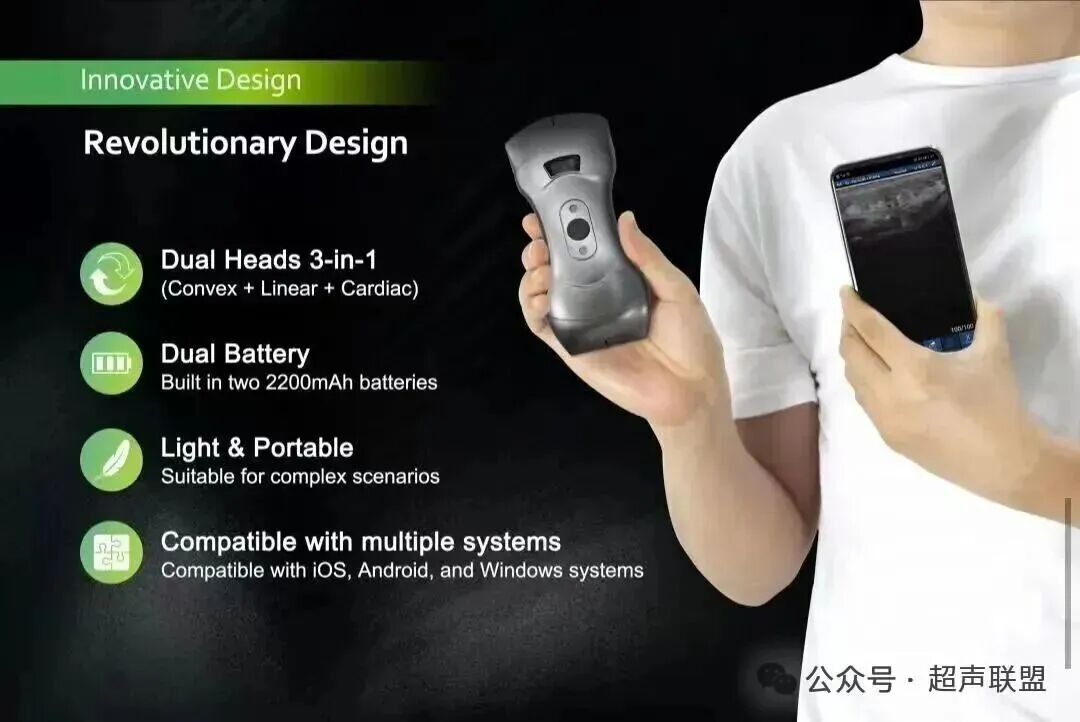 索诺星超声怎么样索诺星和理邦全新彩超机器_https://www.jmylbn.com_新闻资讯_第26张