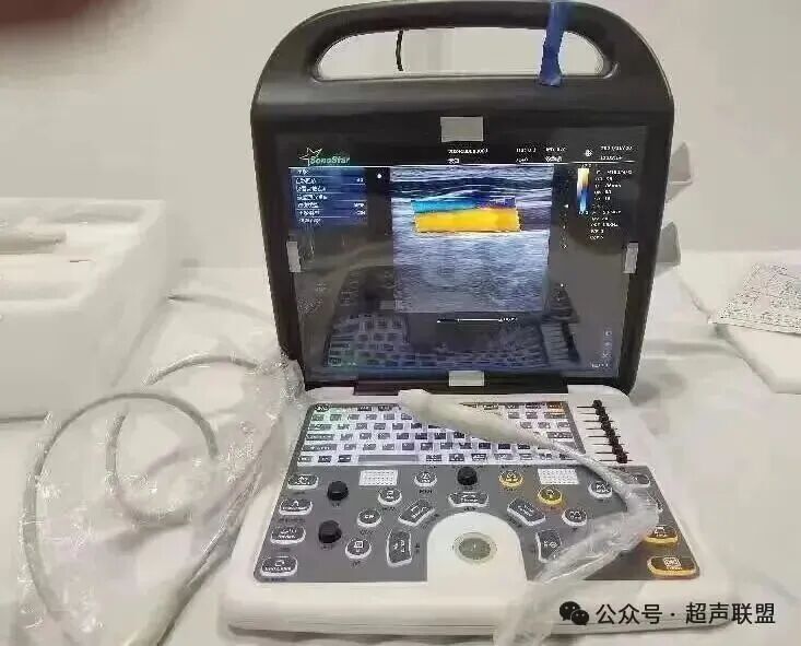 索诺星超声怎么样索诺星和理邦全新彩超机器_https://www.jmylbn.com_新闻资讯_第32张