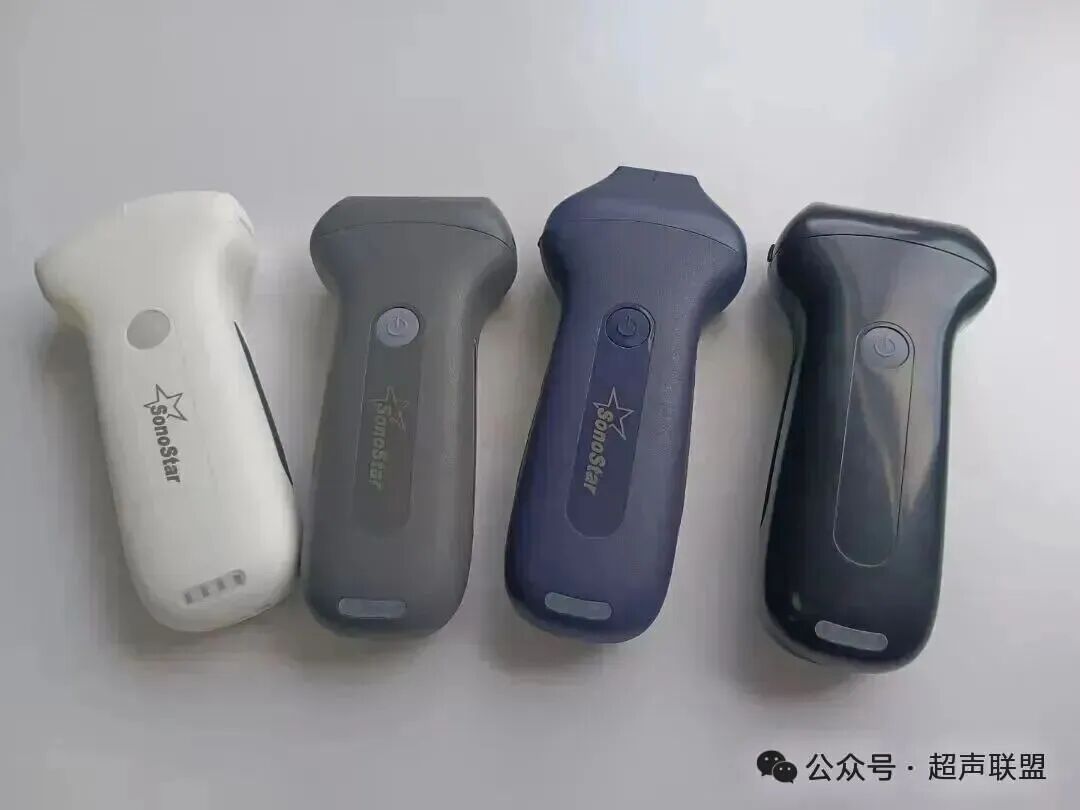 索诺星超声怎么样索诺星和理邦全新彩超机器_https://www.jmylbn.com_新闻资讯_第21张