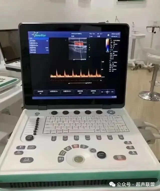 索诺星超声怎么样索诺星和理邦全新彩超机器_https://www.jmylbn.com_新闻资讯_第35张