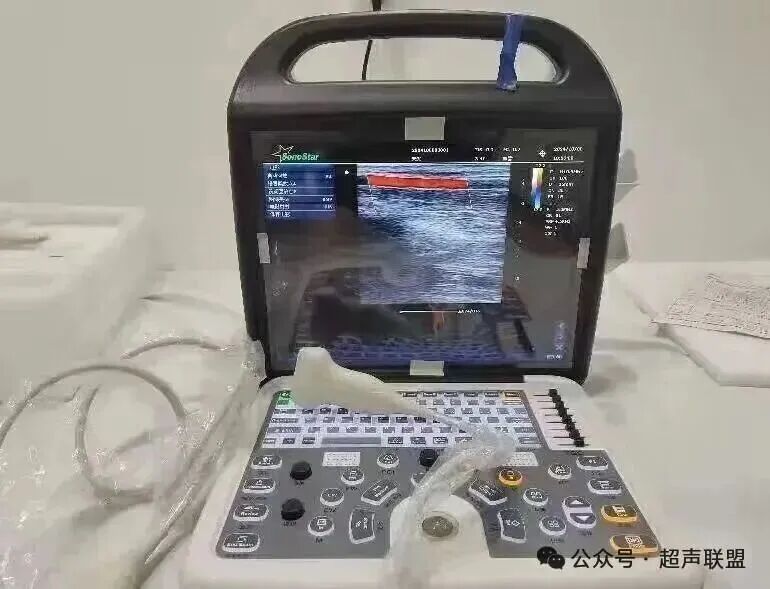 索诺星超声怎么样索诺星和理邦全新彩超机器_https://www.jmylbn.com_新闻资讯_第33张