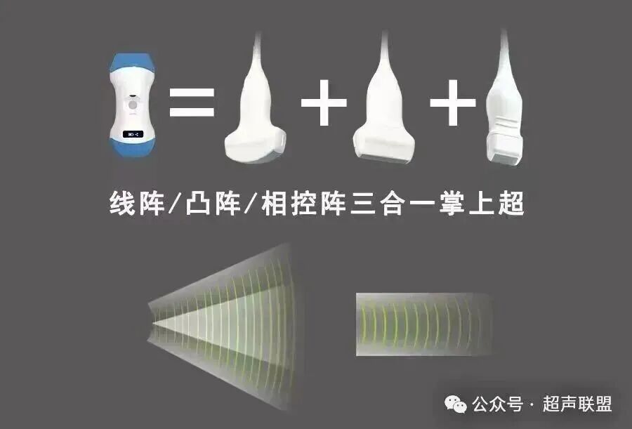 索诺星超声怎么样索诺星和理邦全新彩超机器_https://www.jmylbn.com_新闻资讯_第8张