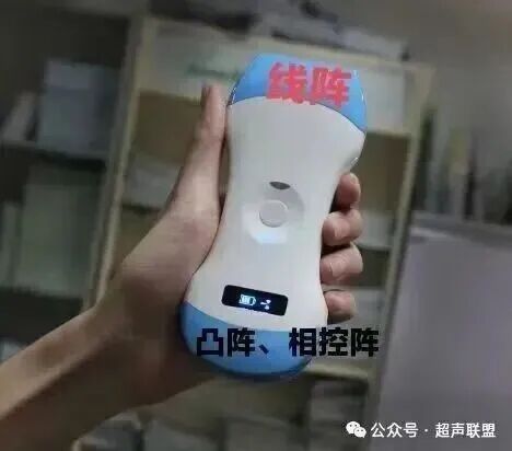 索诺星超声怎么样索诺星和理邦全新彩超机器_https://www.jmylbn.com_新闻资讯_第10张