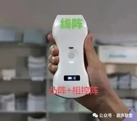 索诺星超声怎么样索诺星和理邦全新彩超机器_https://www.jmylbn.com_新闻资讯_第9张