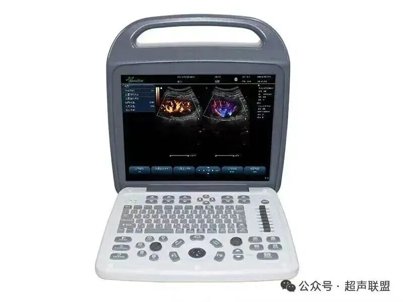 索诺星超声怎么样索诺星和理邦全新彩超机器_https://www.jmylbn.com_新闻资讯_第27张