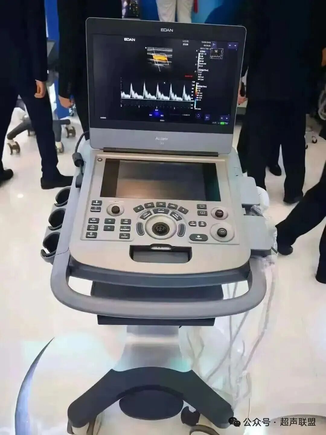 索诺星超声怎么样索诺星和理邦全新彩超机器_https://www.jmylbn.com_新闻资讯_第42张