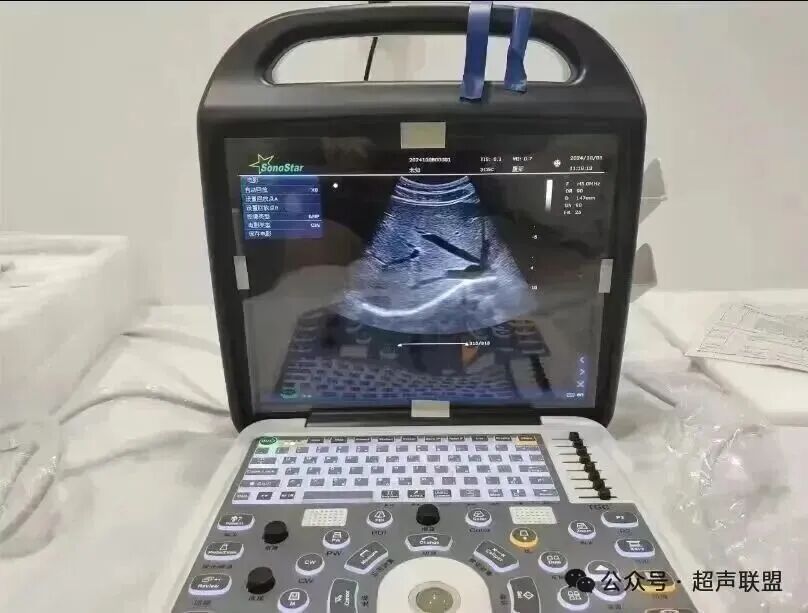 索诺星超声怎么样索诺星和理邦全新彩超机器_https://www.jmylbn.com_新闻资讯_第34张
