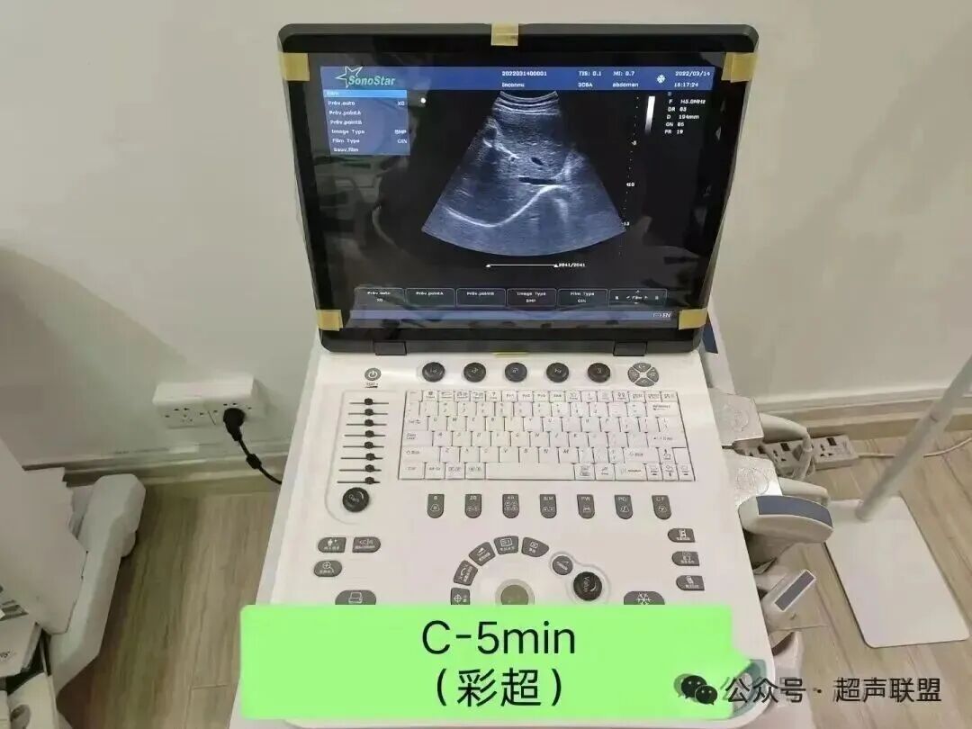索诺星超声怎么样索诺星和理邦全新彩超机器_https://www.jmylbn.com_新闻资讯_第36张