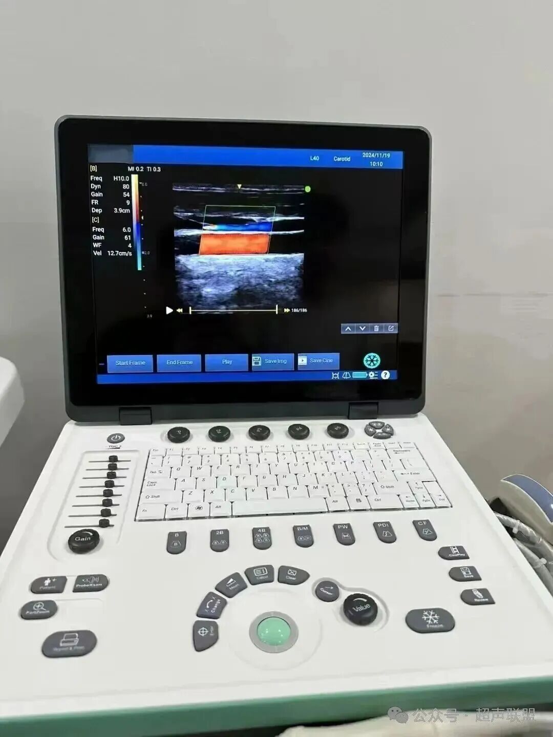 索诺星超声怎么样索诺星和理邦全新彩超机器_https://www.jmylbn.com_新闻资讯_第37张