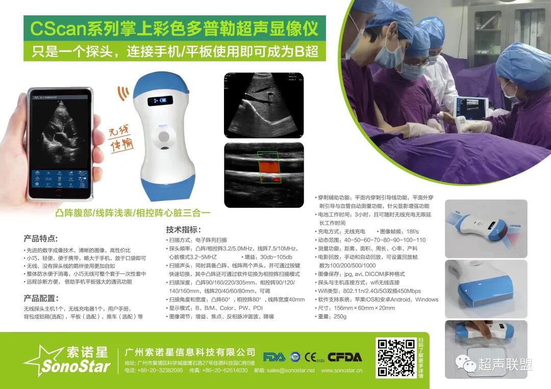 索诺星超声怎么样骶尾部藏毛窦广东（广州）索诺星无线掌超现场试机活动，无线掌超，值得拥有_https://www.jmylbn.com_新闻资讯_第8张