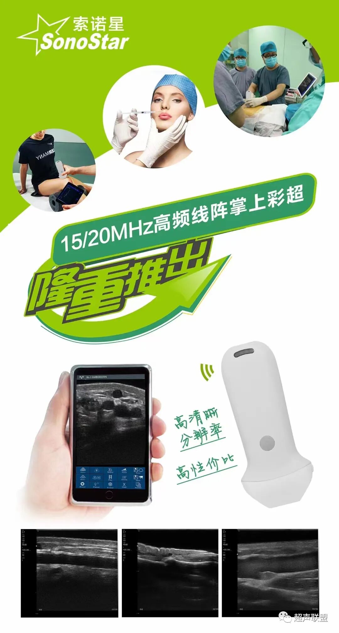 索诺星超声怎么样骶尾部藏毛窦广东（广州）索诺星无线掌超现场试机活动，无线掌超，值得拥有_https://www.jmylbn.com_新闻资讯_第19张