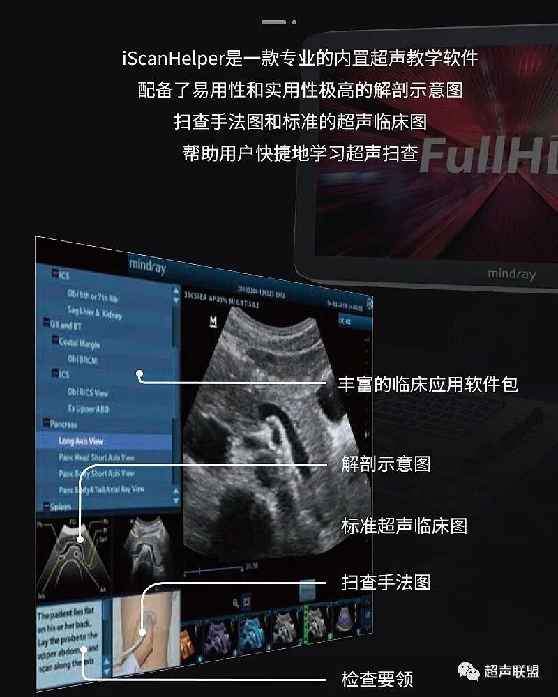 迈瑞彩超有哪些型号迈瑞彩超机器_https://www.jmylbn.com_新闻资讯_第26张