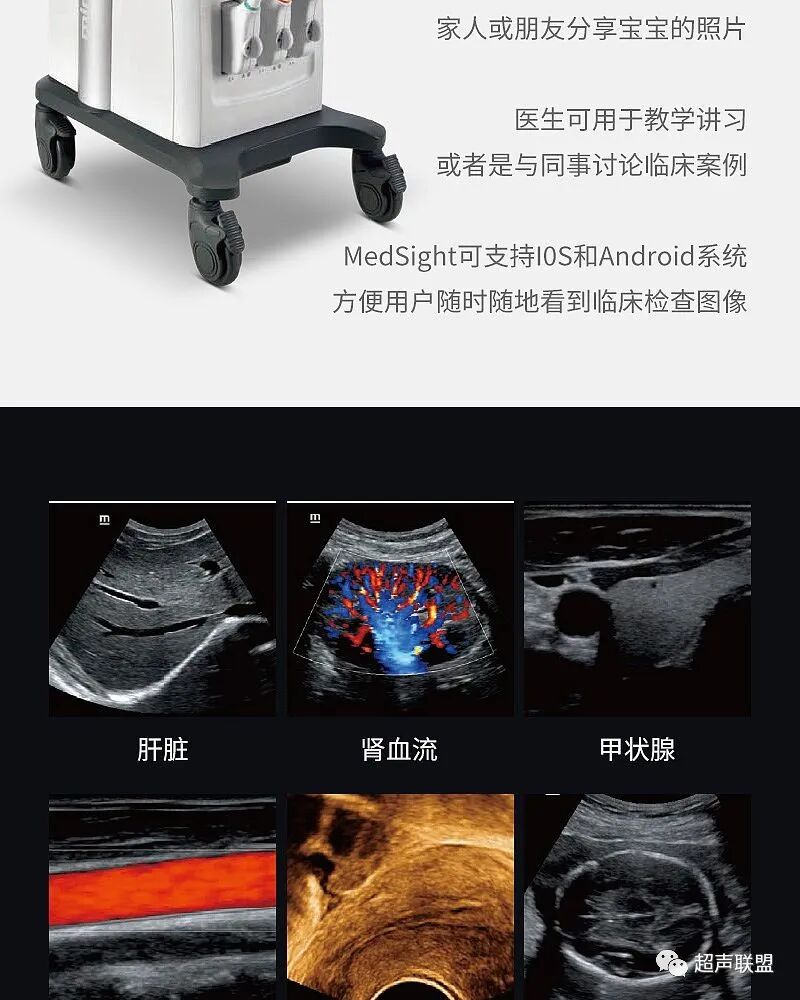 迈瑞彩超有哪些型号迈瑞彩超机器_https://www.jmylbn.com_新闻资讯_第28张