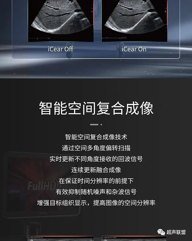 迈瑞彩超有哪些型号迈瑞彩超机器_https://www.jmylbn.com_新闻资讯_第21张