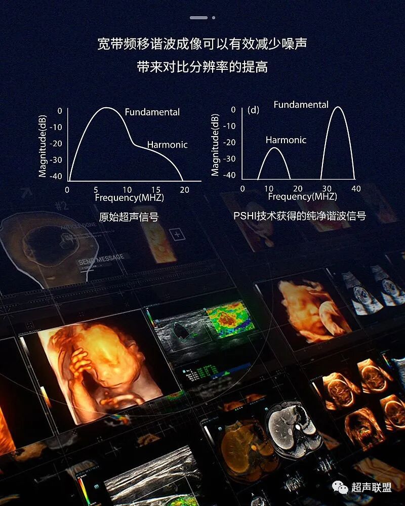 迈瑞彩超有哪些型号迈瑞彩超机器_https://www.jmylbn.com_新闻资讯_第19张