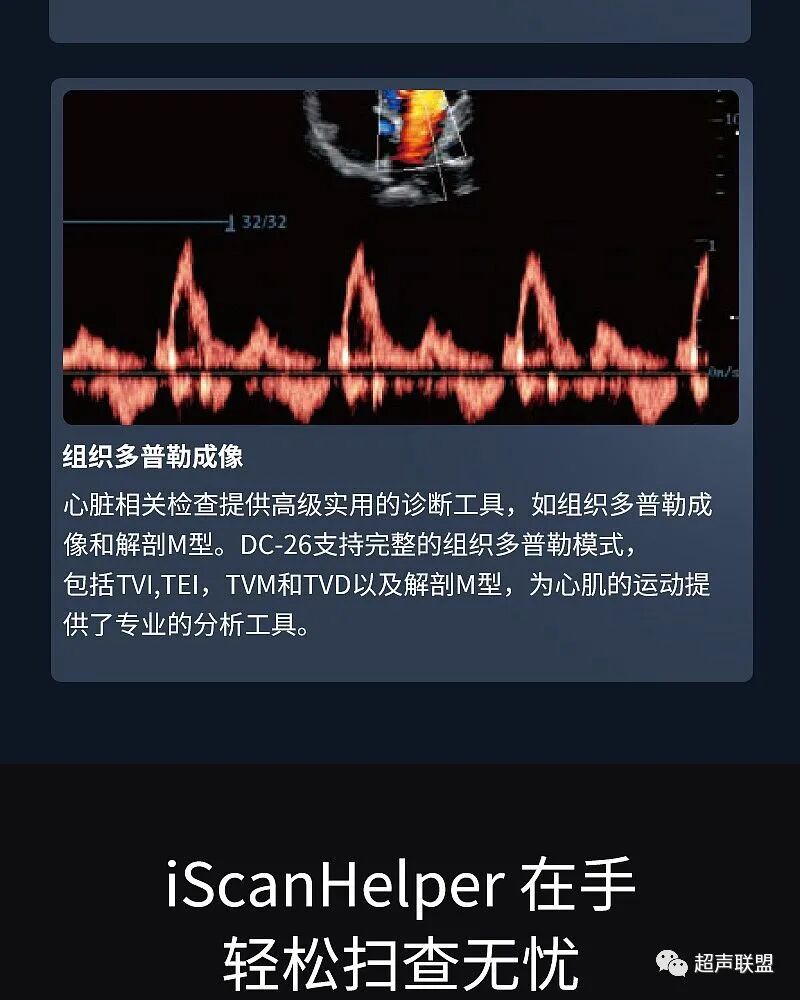 迈瑞彩超有哪些型号迈瑞彩超机器_https://www.jmylbn.com_新闻资讯_第25张