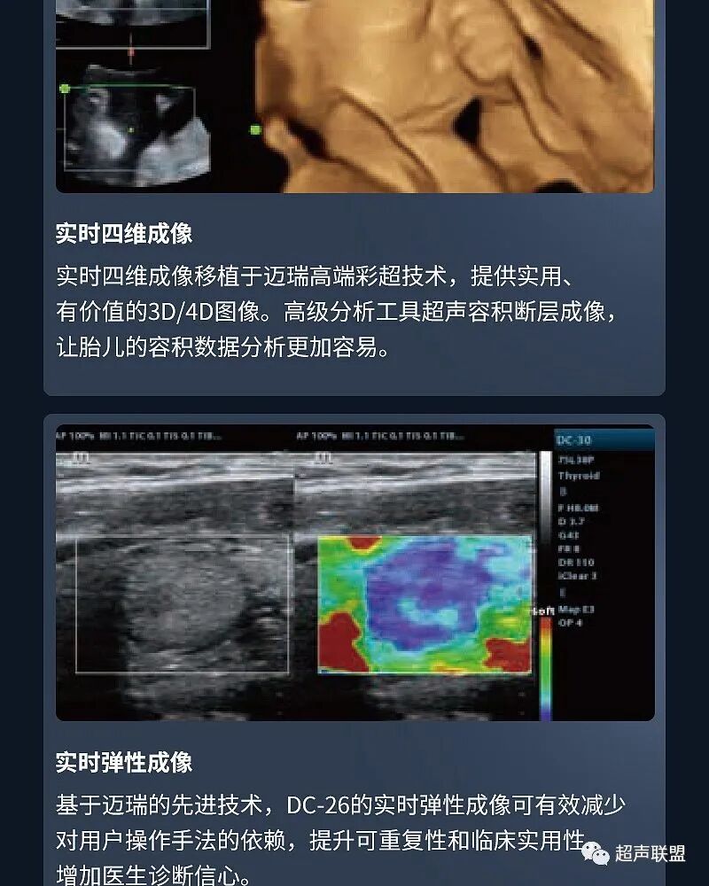 迈瑞彩超有哪些型号迈瑞彩超机器_https://www.jmylbn.com_新闻资讯_第24张