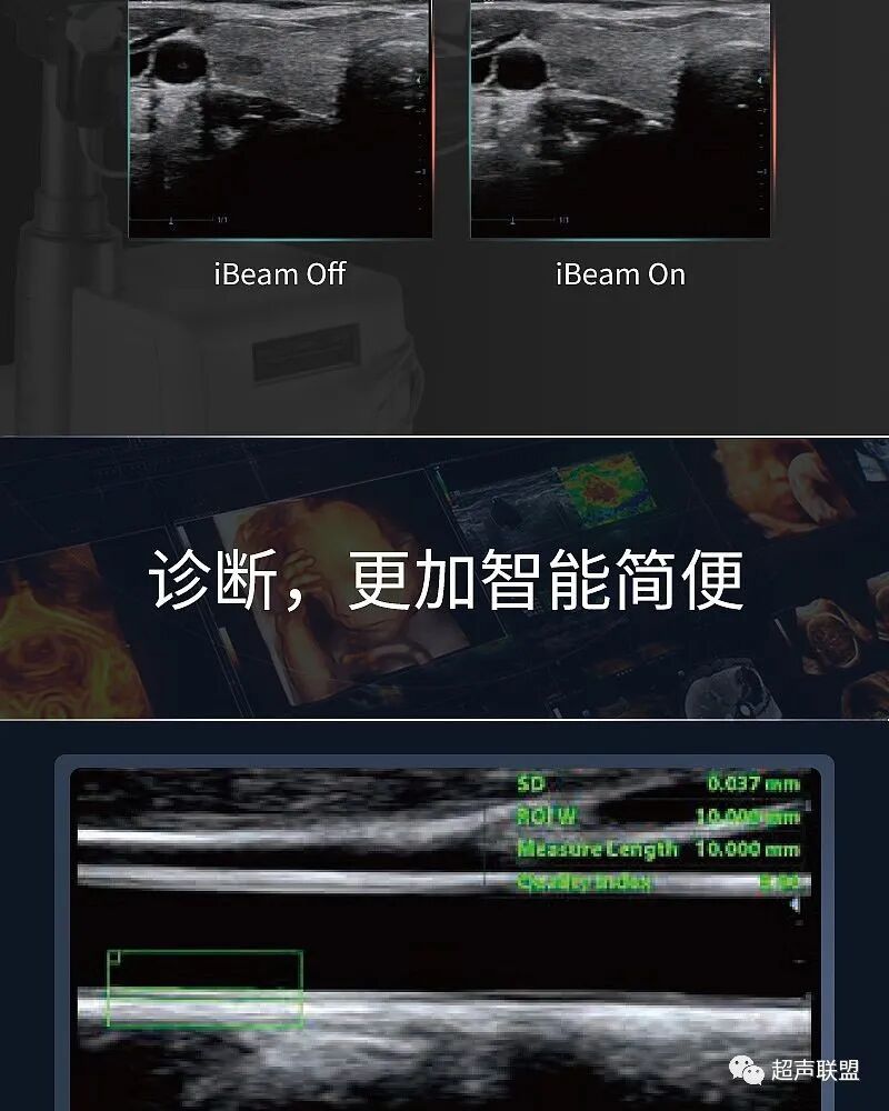 迈瑞彩超有哪些型号迈瑞彩超机器_https://www.jmylbn.com_新闻资讯_第22张