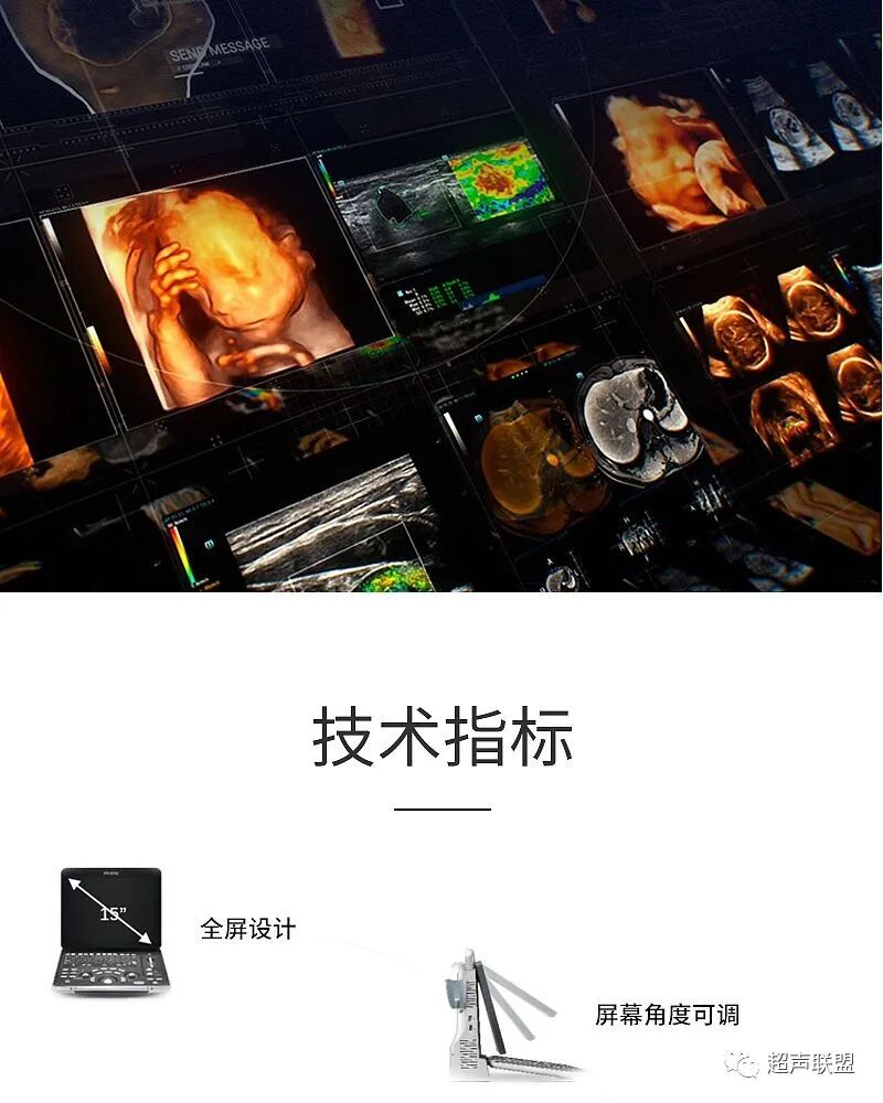 迈瑞彩超有哪些型号迈瑞彩超机器_https://www.jmylbn.com_新闻资讯_第50张