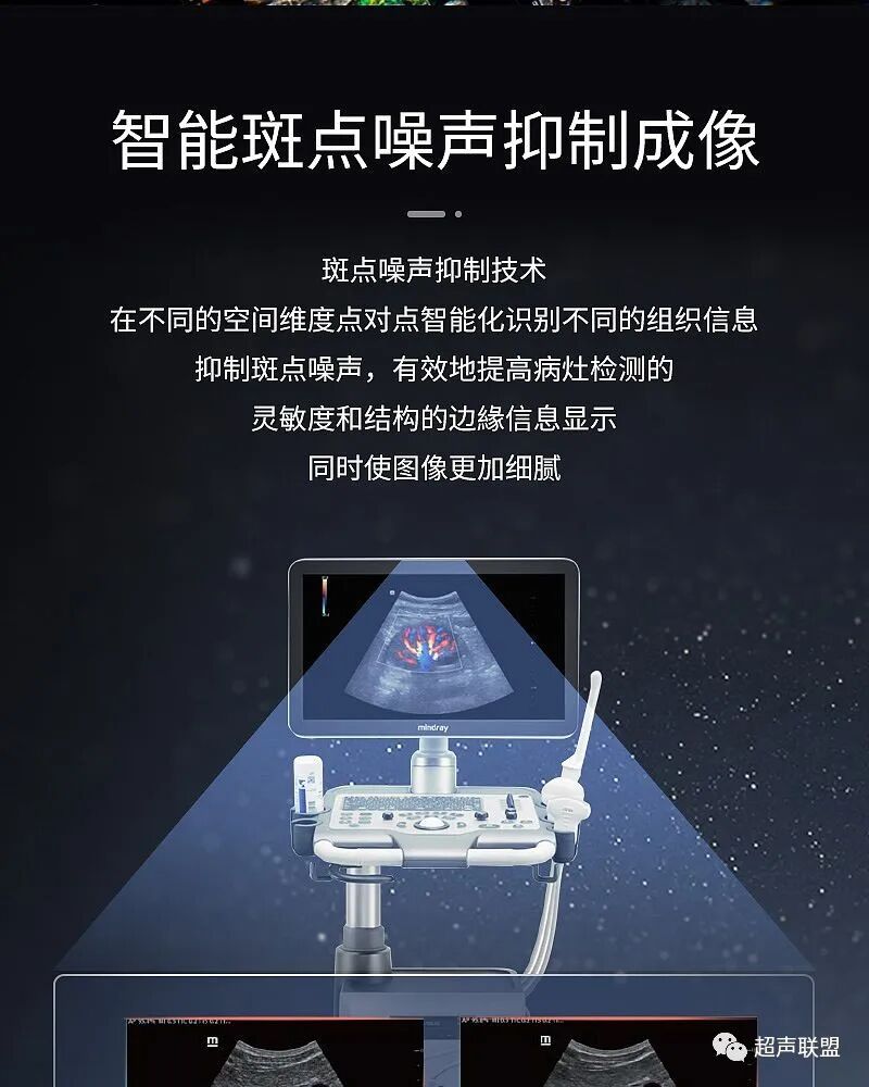 迈瑞彩超有哪些型号迈瑞彩超机器_https://www.jmylbn.com_新闻资讯_第20张