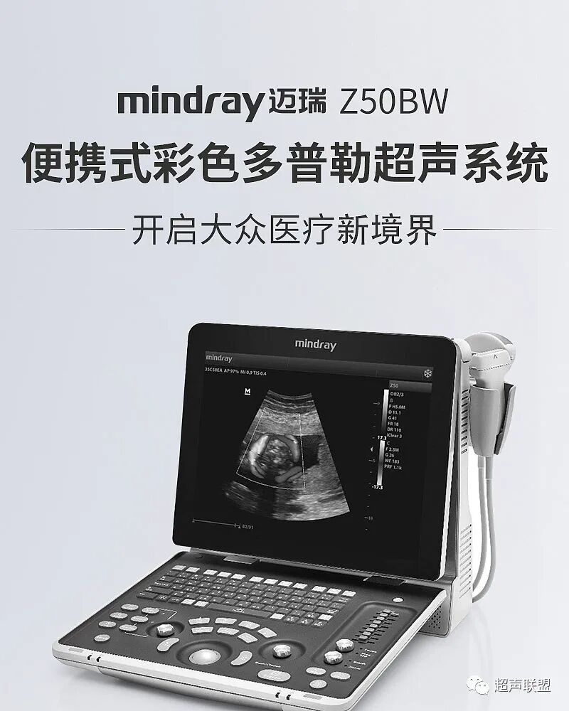 迈瑞彩超有哪些型号迈瑞彩超机器_https://www.jmylbn.com_新闻资讯_第47张