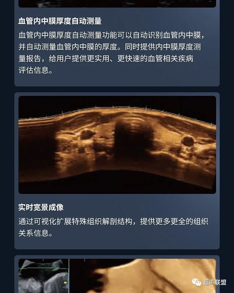 迈瑞彩超有哪些型号迈瑞彩超机器_https://www.jmylbn.com_新闻资讯_第23张