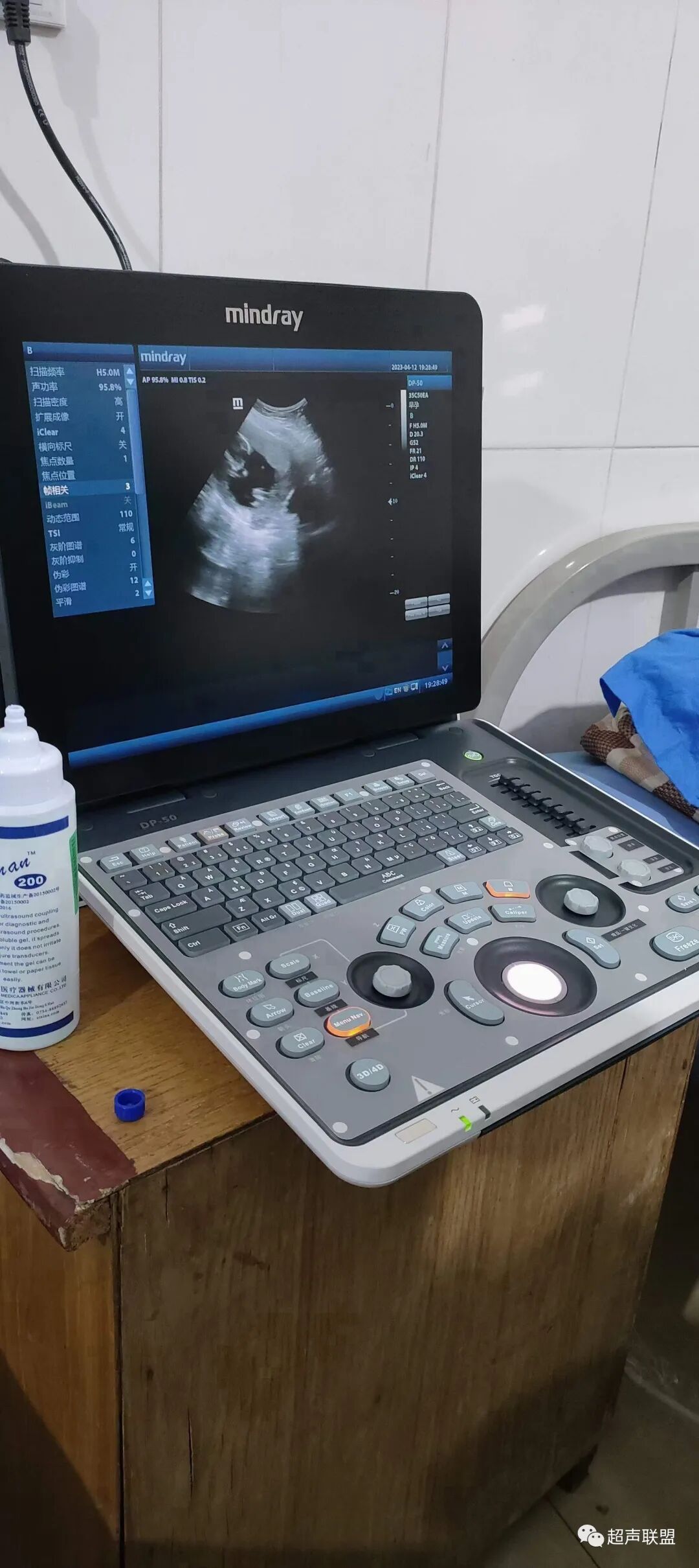 迈瑞彩超有哪些型号迈瑞彩超机器_https://www.jmylbn.com_新闻资讯_第15张