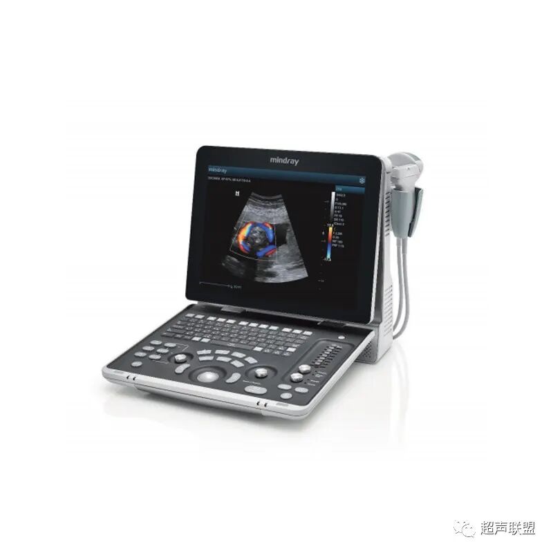 迈瑞彩超有哪些型号迈瑞彩超机器_https://www.jmylbn.com_新闻资讯_第46张