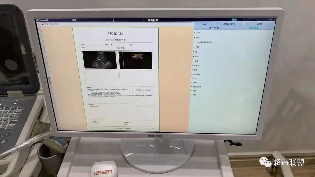 索诺星超声怎么样骶尾部藏毛窦广东（广州）索诺星无线掌超现场试机活动，无线掌超，值得拥有_https://www.jmylbn.com_新闻资讯_第18张