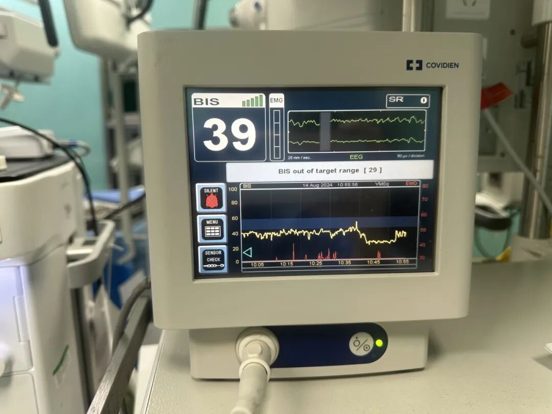 麻醉监测仪有哪些【麻醉监护设备】为生命护航的科技力量_https://www.jmylbn.com_新闻资讯_第5张