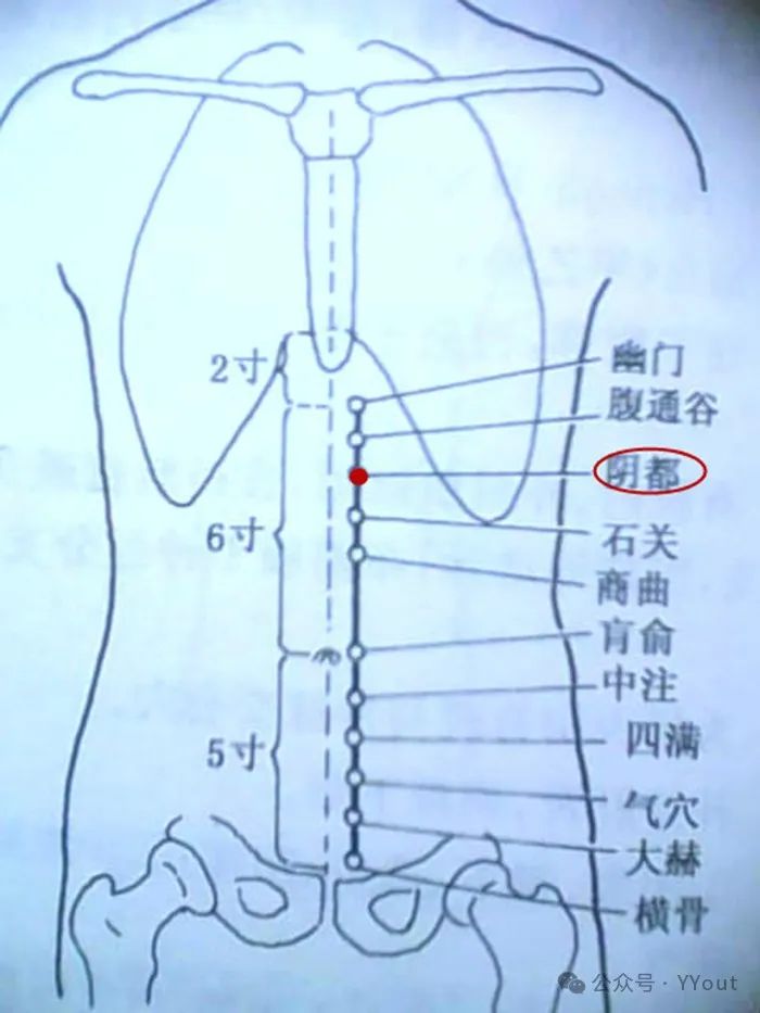 中脘、阴都、肾俞3穴上，上盖纱布，用麦麸子炒热，布包，轮换熨敷3穴。