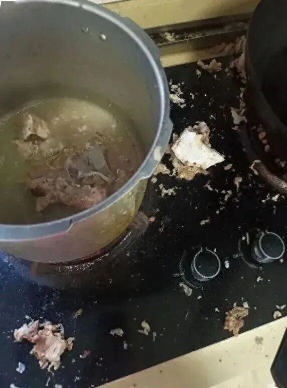 “高压锅炸了！”女子头部被锅盖击中，颅脑重伤被送进ICU