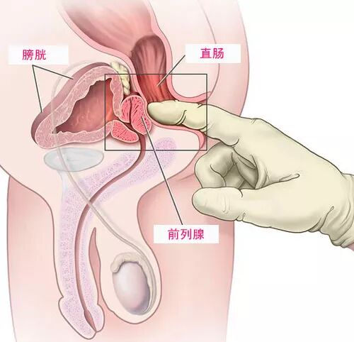 看完这篇前列腺g点科普 算是真正掌握了男人第二快感 自由微信 Freewechat