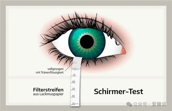 泪液分泌滤纸怎么使用干眼 ｜ 干眼临床检查和诊断器械（一）_https://www.jmylbn.com_新闻资讯_第1张