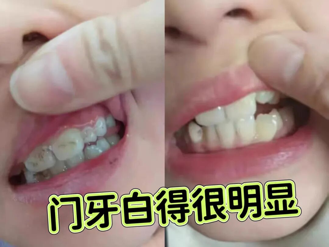 治疗床怎么用看着在治疗床上哇哇哭的孩子，“再也不敢了，这一件我还是老老实实给孩子买贵的…”_https://www.jmylbn.com_新闻资讯_第18张