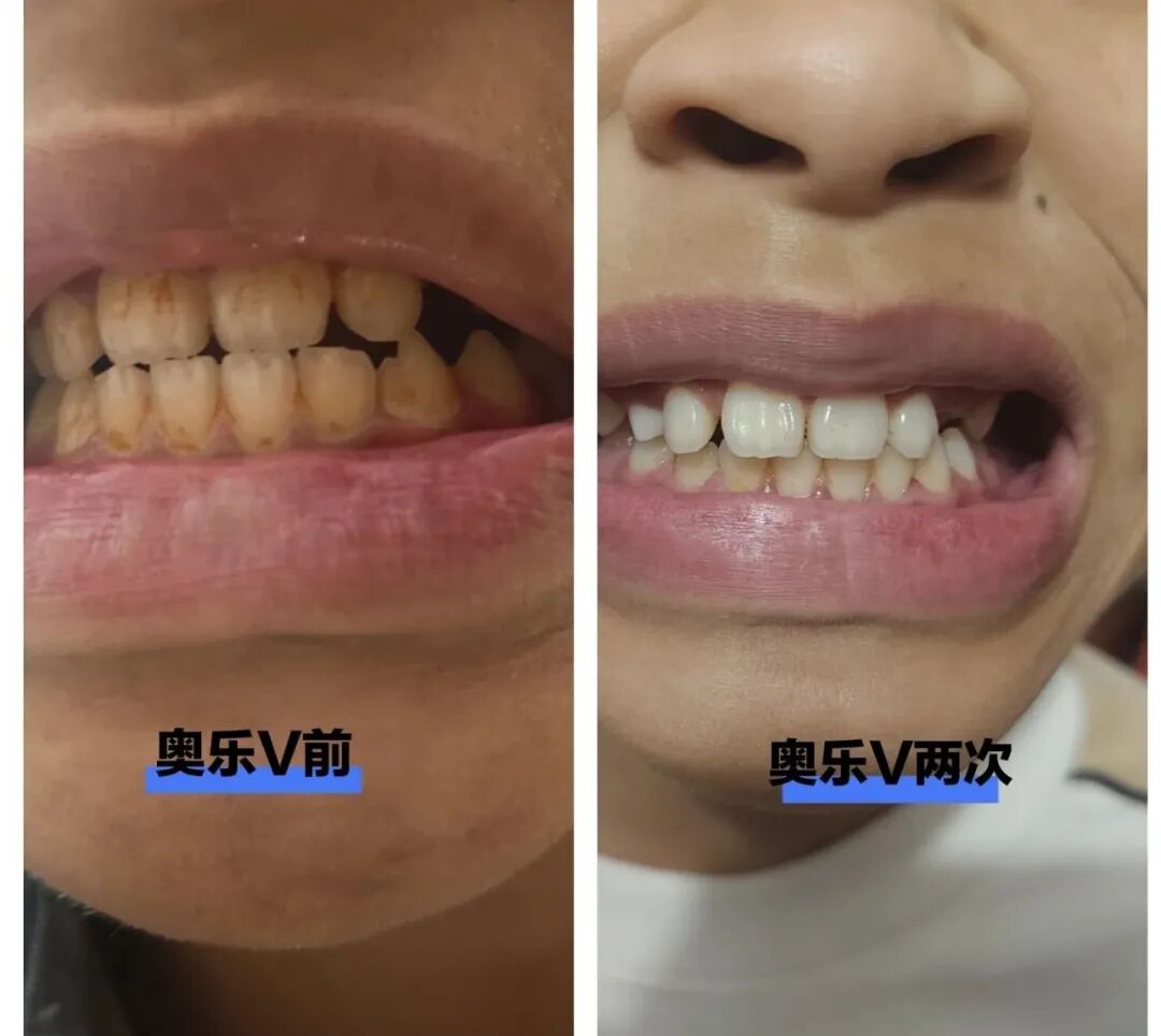 治疗床怎么用看着在治疗床上哇哇哭的孩子，“再也不敢了，这一件我还是老老实实给孩子买贵的…”_https://www.jmylbn.com_新闻资讯_第17张