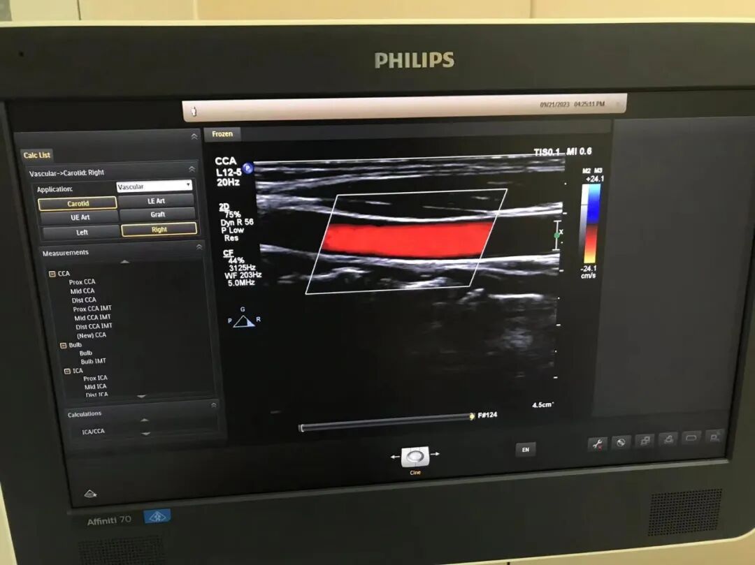 为什么要维修探头飞利浦高频探头L12-5故障维修案例_https://www.jmylbn.com_新闻资讯_第4张
