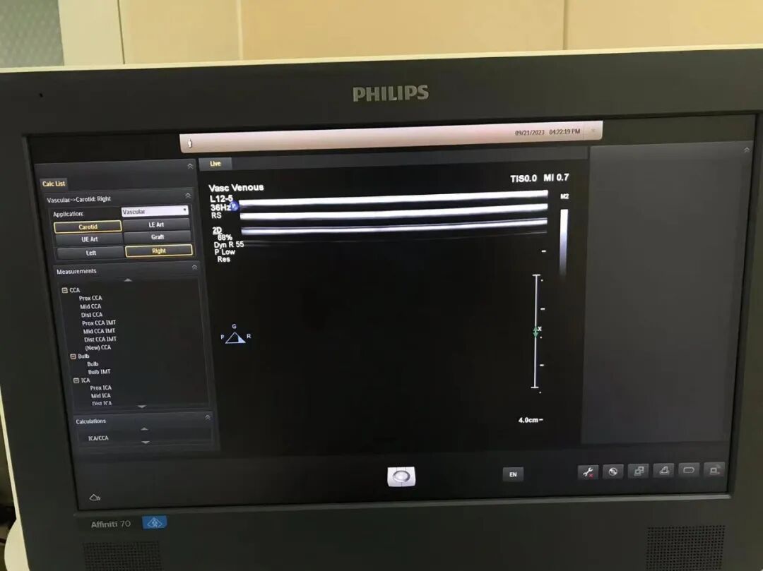 为什么要维修探头飞利浦高频探头L12-5故障维修案例_https://www.jmylbn.com_新闻资讯_第3张